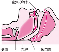 睡眠時無呼吸症候群(SAS)について｜新宿睡眠・呼吸器内科クリニック